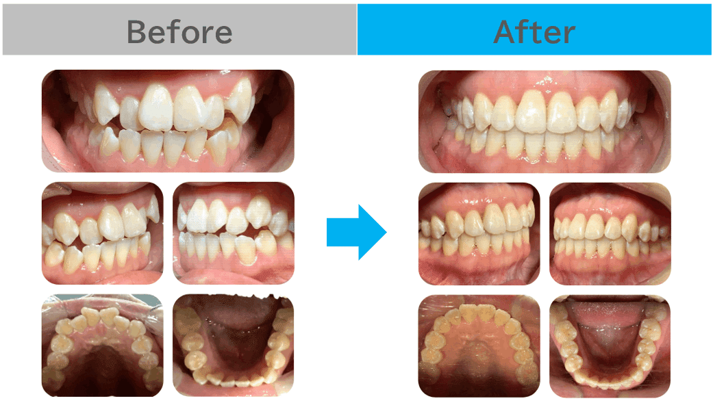 これで解決!矯正トラブル マウスピース型矯正、MTM、再治療等の“困った”