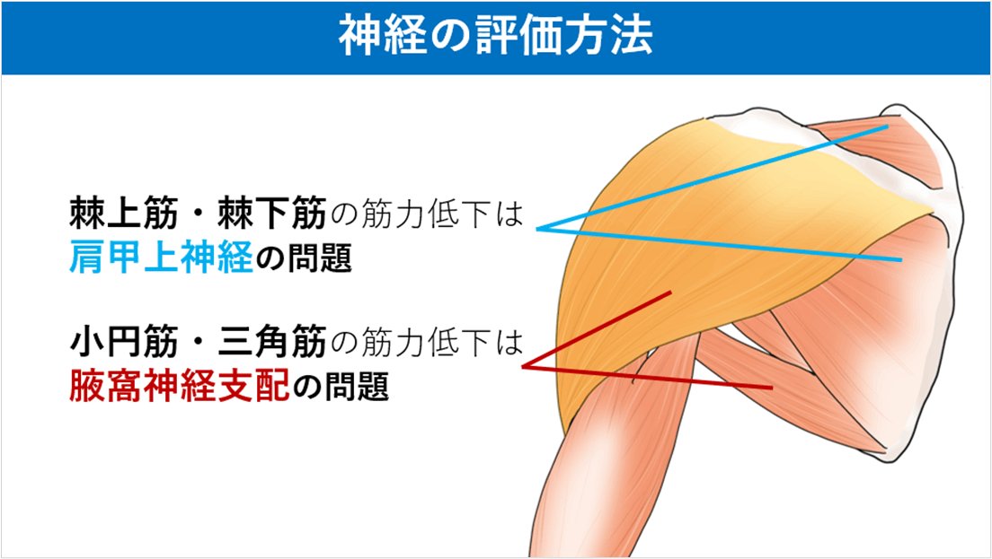 腋窩神経機能障害はどのように治療されますか?