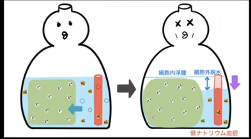 経口補水療法の潜在的なリスクと副作用