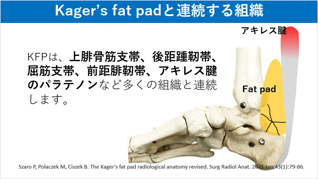 Kager’S Fat Pad Inflammation – Inflammatory mechanisms linking obesity ...