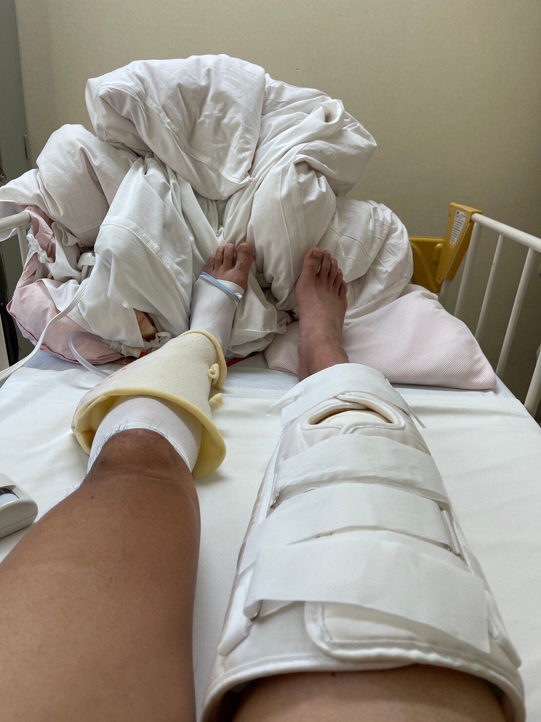 ご報告と備忘録】前十字靭帯再建手術終えて。｜ねぎお社長｜AI時代の