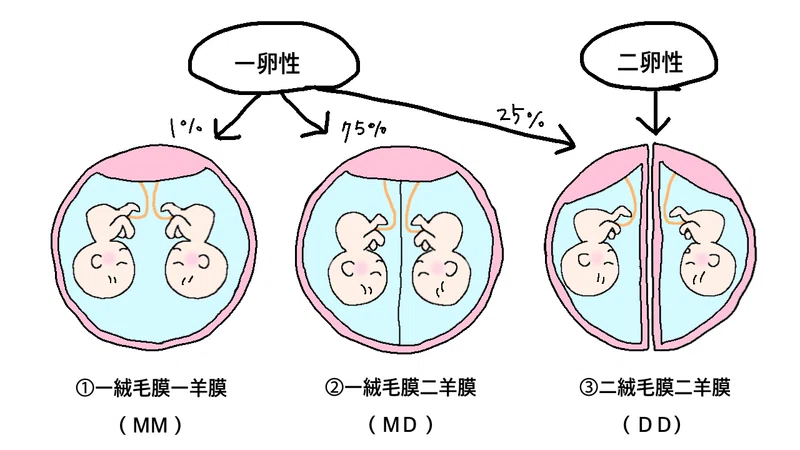 -双子を妊娠したら知っておいた方がよいこと-｜aoi｜note