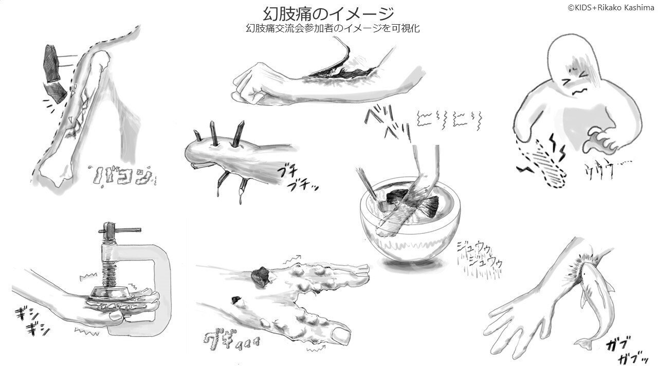 お歳暮･冬ギフト2024｜ギフト・贈り物はセブン 幻肢痛チャリティーイベントのお知らせ】2月11日（土）にmashup その他