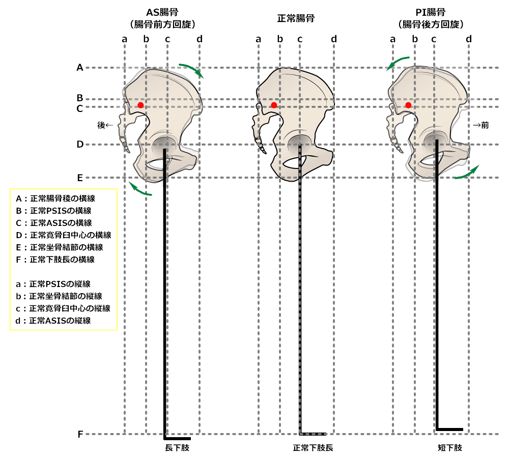 骨盤のゆがみは3Dで捉えよう｜Swingman's Lab.