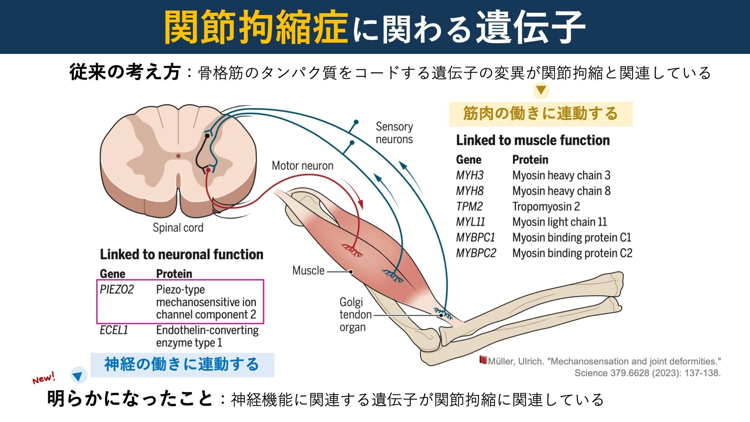 体性感覚の過活動は、関節拘縮を引き起こす｜Super Human | 理学療法士