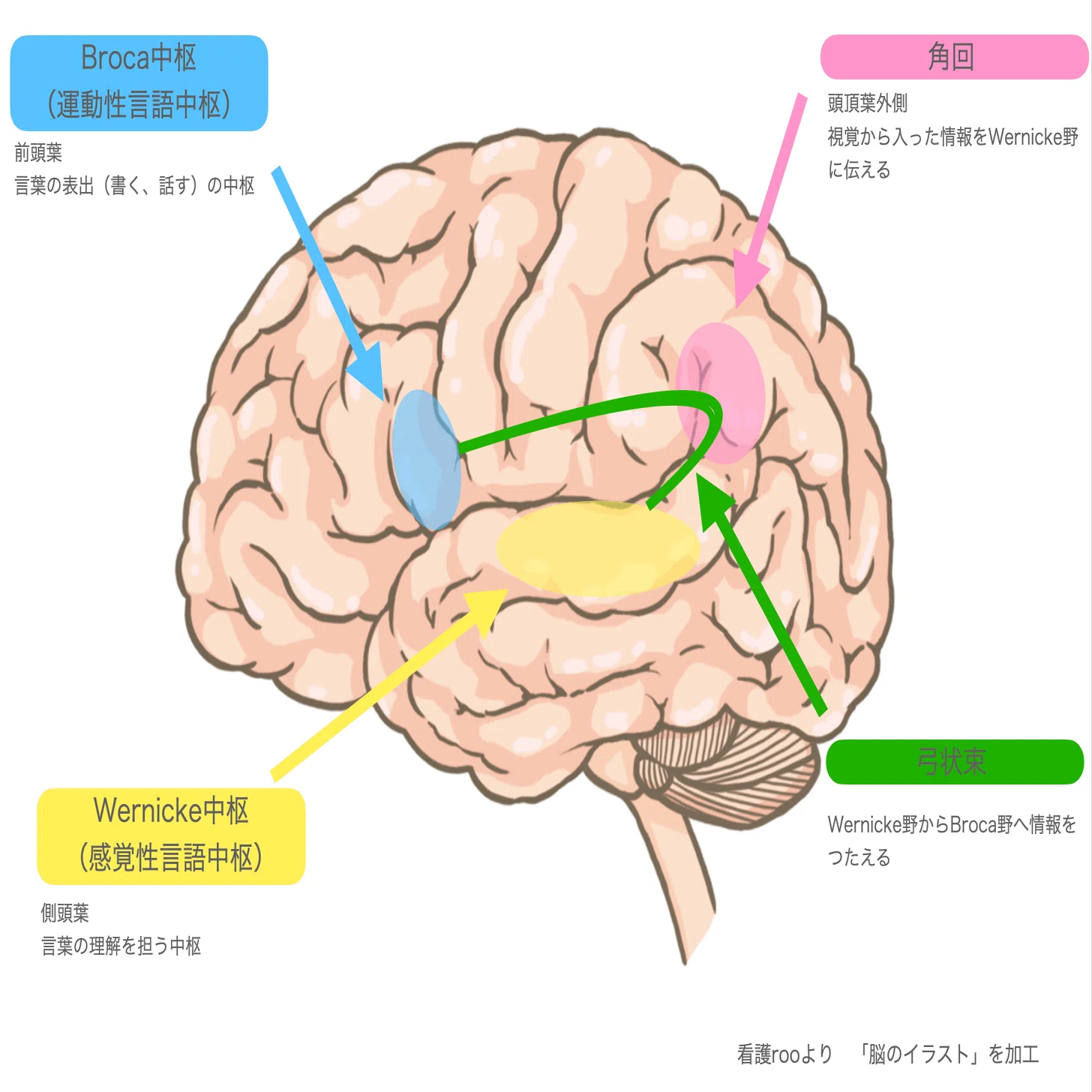 失語症ってなあに？｜もりもり