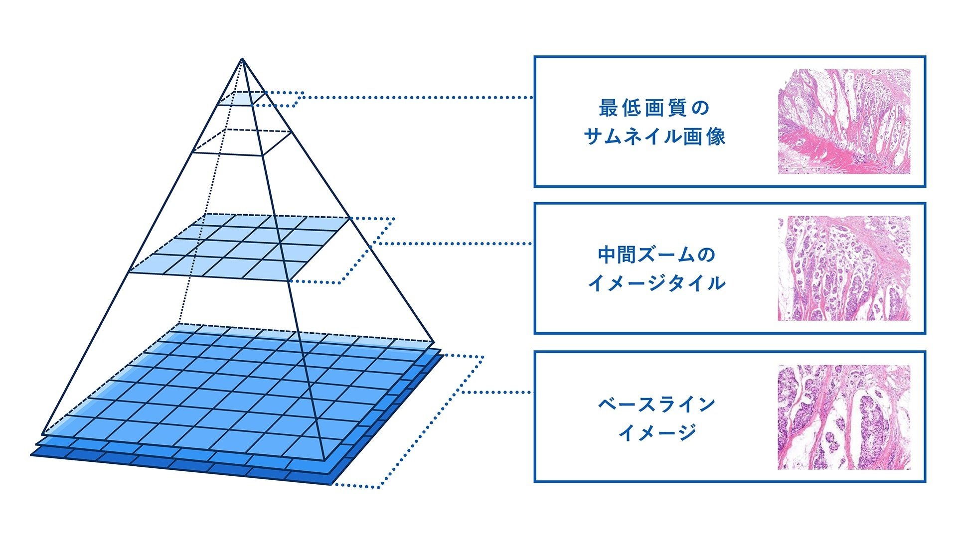 AIの目で病理組織を視て創薬につなげる 深層学習によるデジタル