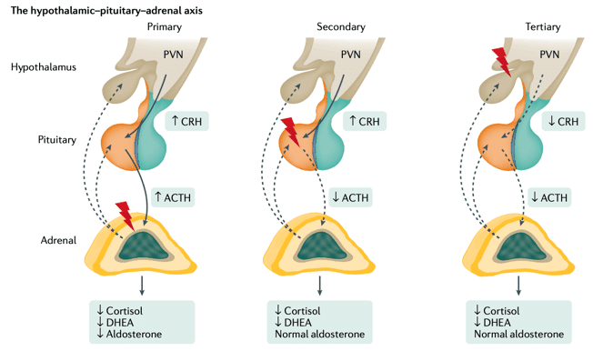 副腎不全の診断・治療｜Gajumaruのメディカルワークアウト