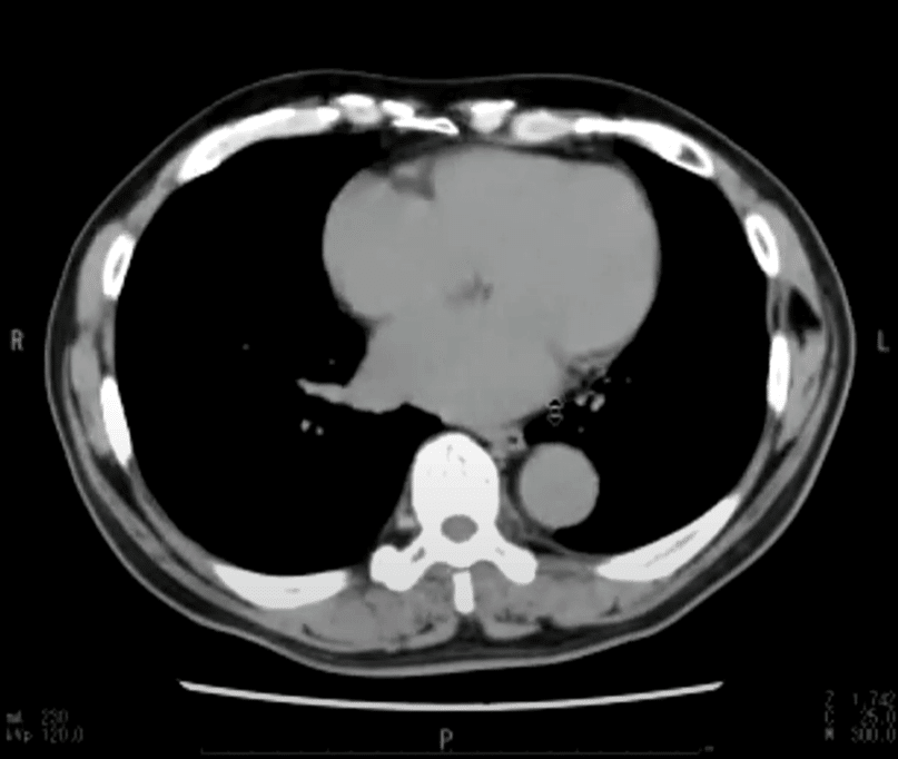 胸部のCT 胸部CT | 画像診断検査 | 各検査を知る | 人間ドック | 健診会
