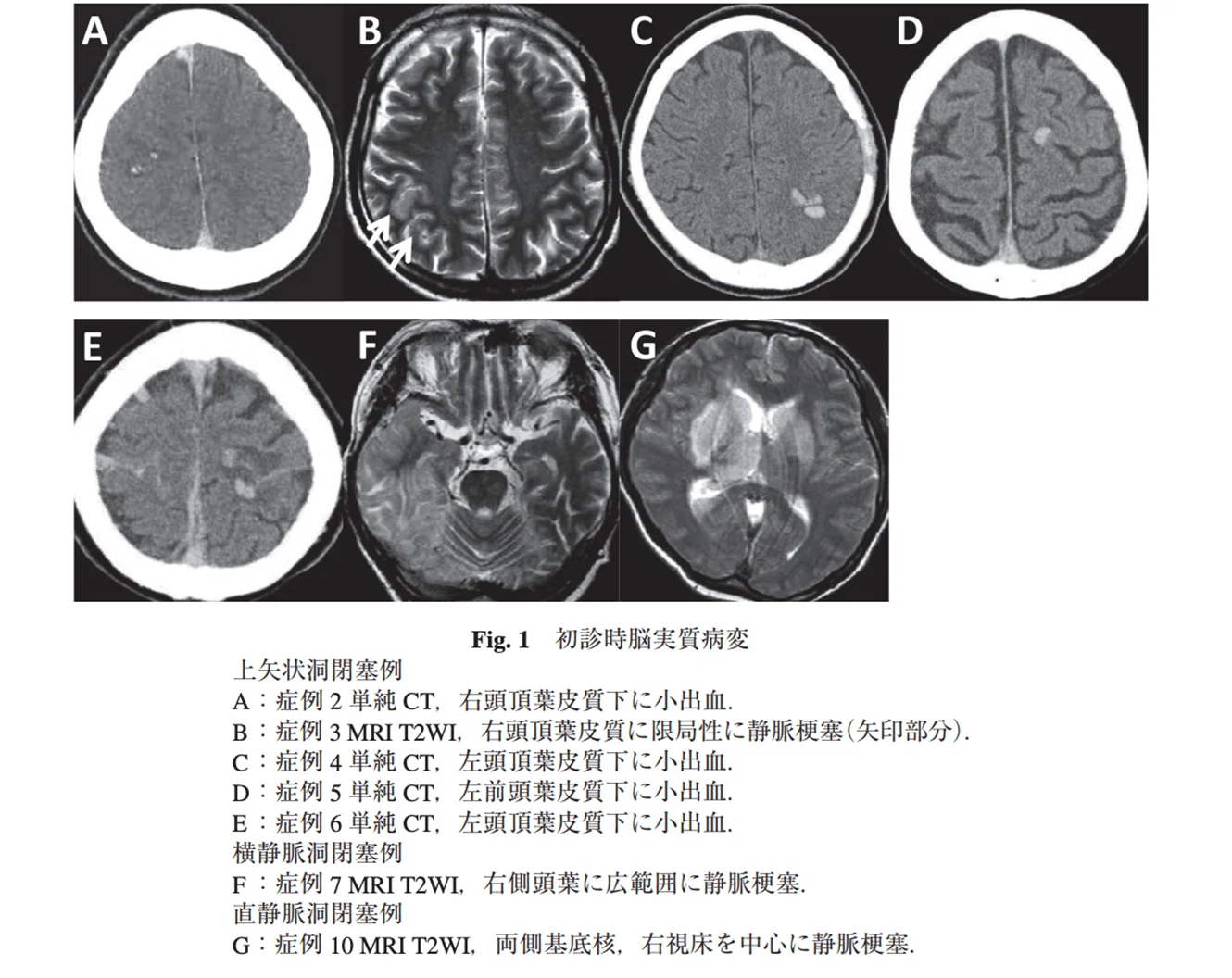 MVP CT/MRIアトラス 裁断済 MVP CT/MRIアトラス 病変類似所見 正常変異 偽病変 裁断済】MVP CT/MRI