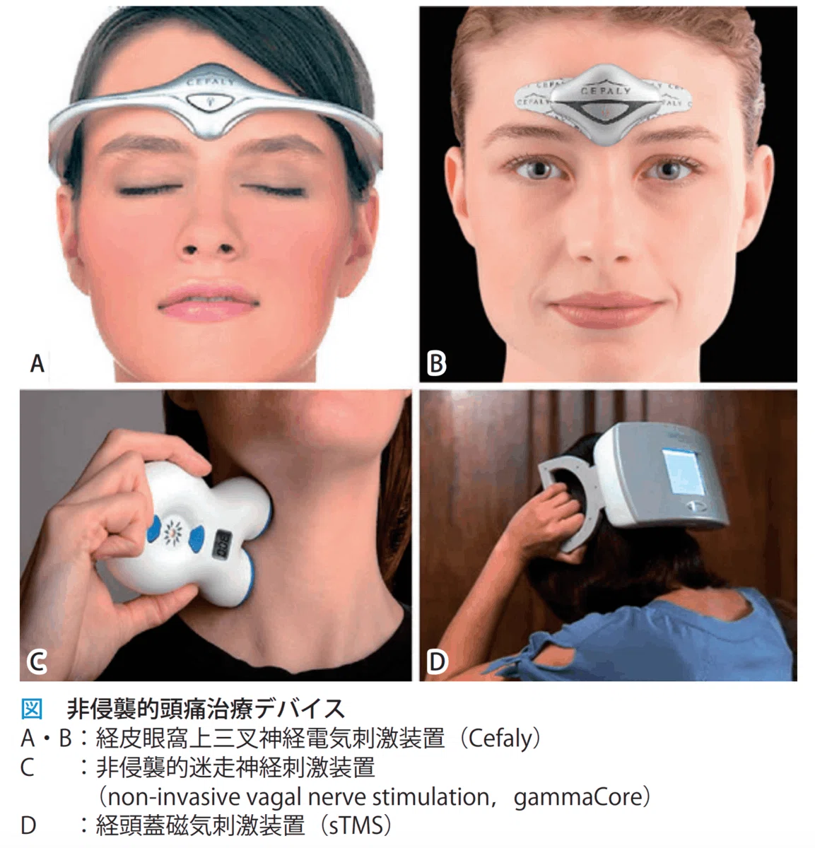 経頭蓋磁気刺激装置などのニューロモデュレーション機器の外観