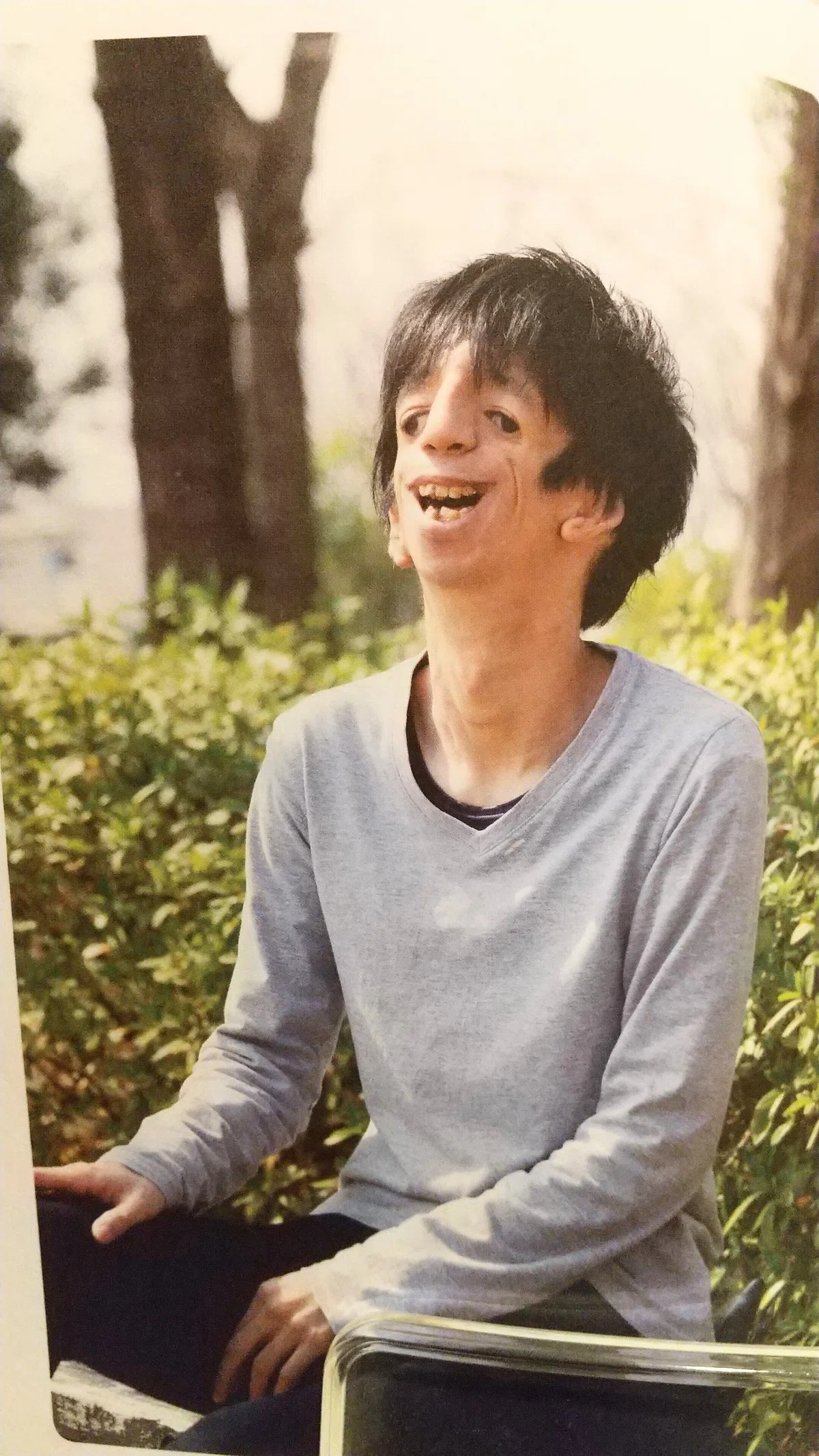 読書】『この顔と生きるということ』／見た目問題によせて｜さち