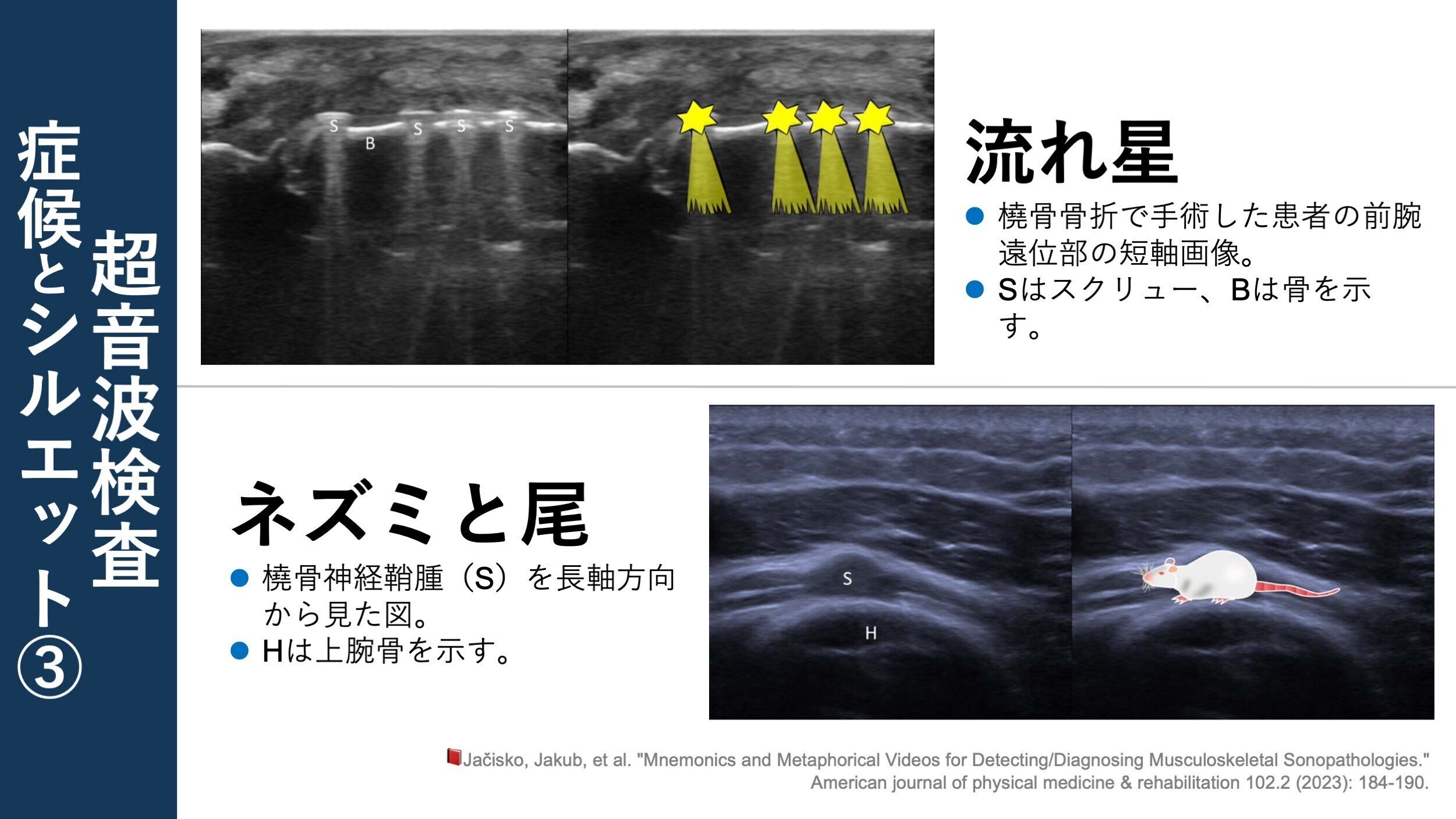 日超検 腹部超音波テキスト第3版 | 日本超音波検査学会, 南里 和