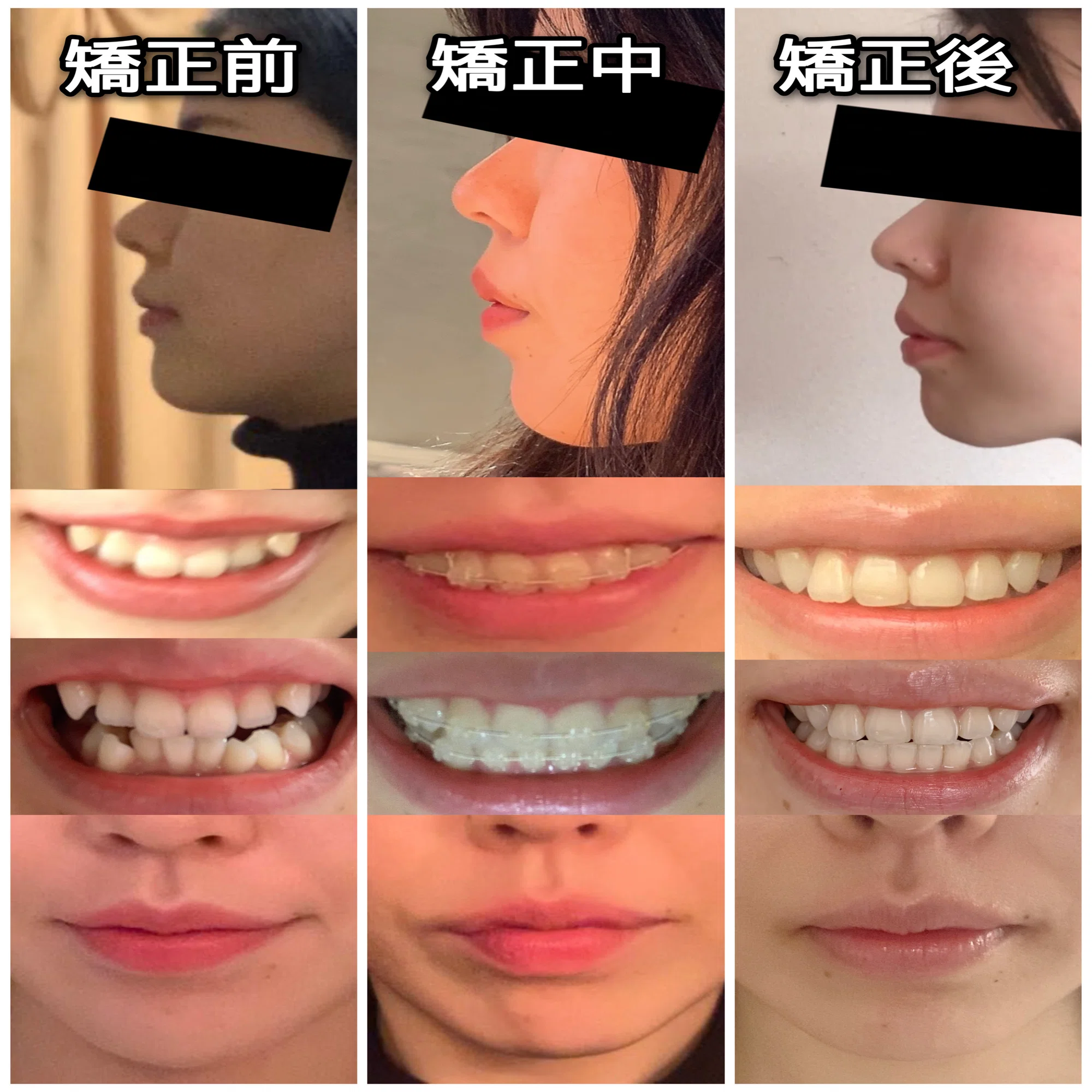 当時のメディア報道・掲載写真