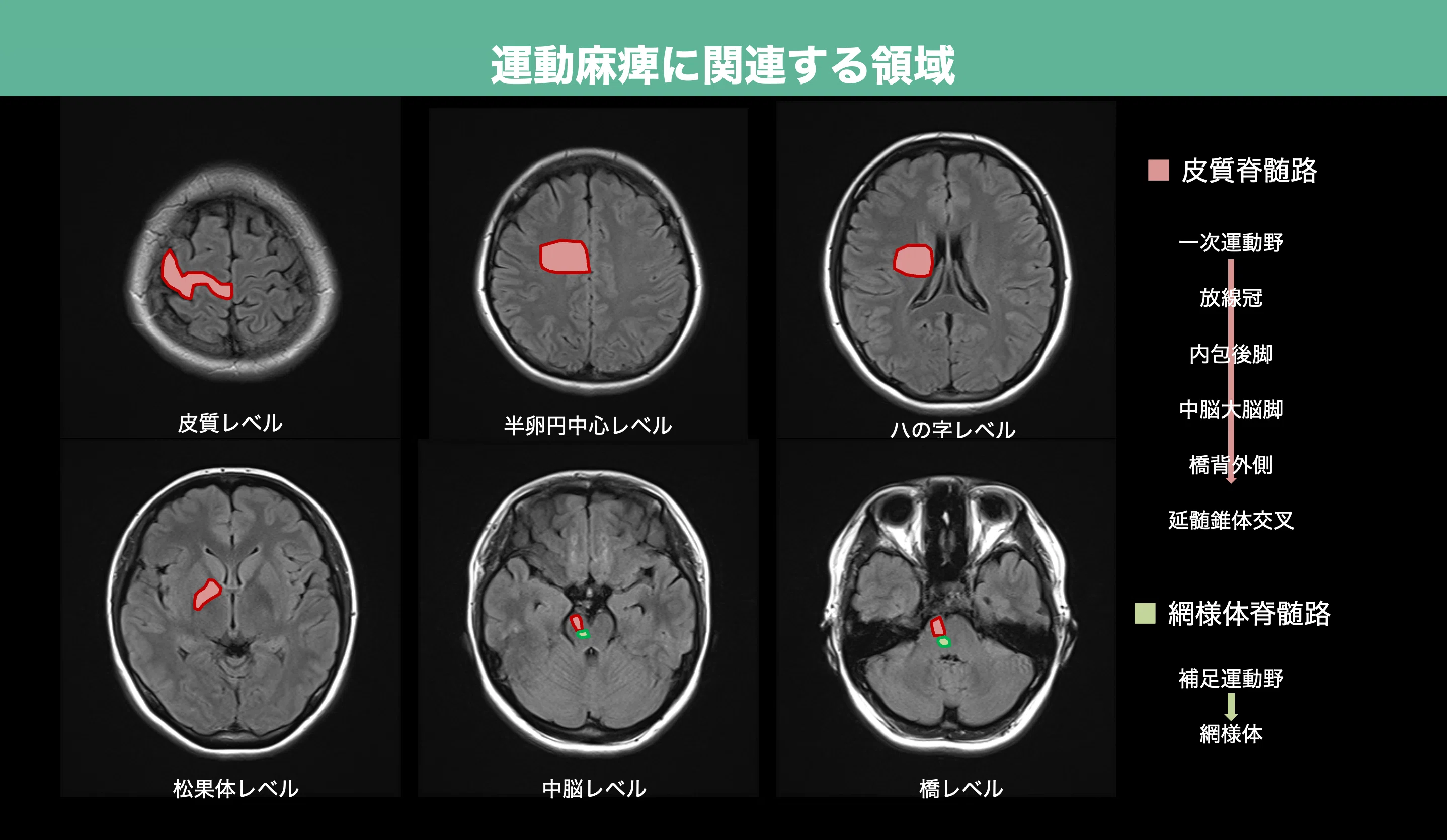 脳画像でみる機能局在とその役割｜ゆうや｜認定／専門理学療法士