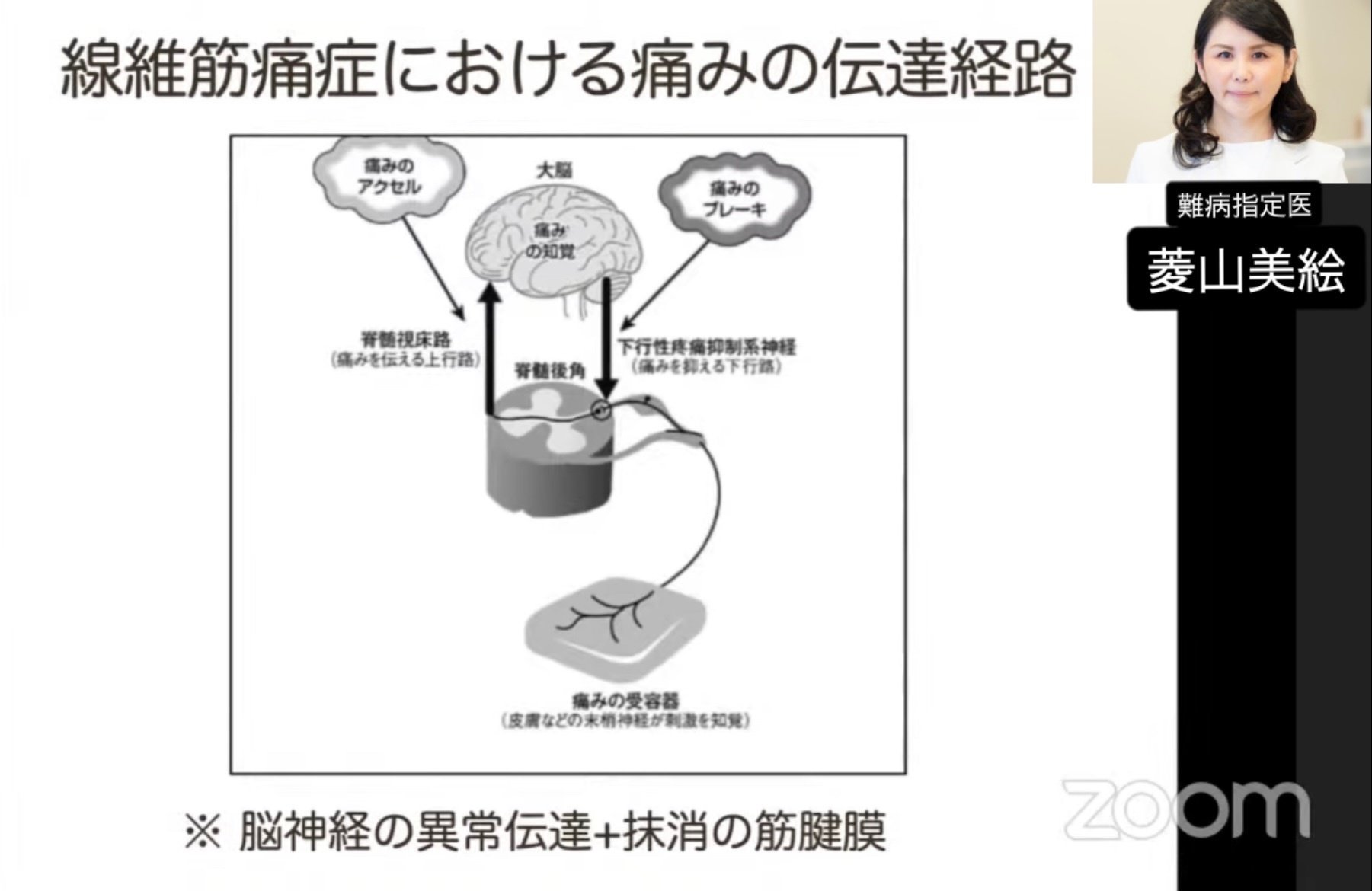 線維筋痛症の標準治療と新規治療-患者,御家族向け解説|痛み分析 線維筋痛症の標準治療と新規治療-患者,御家族向け解説|痛み分析