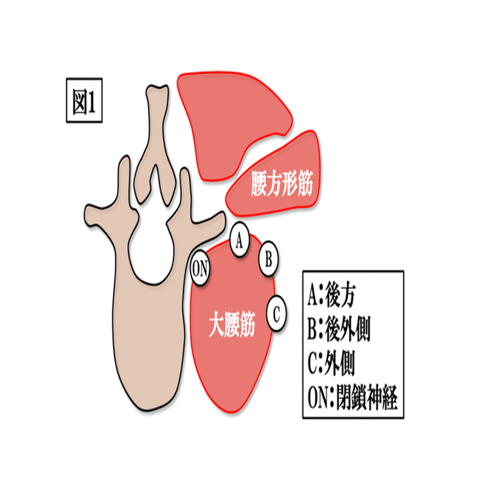 図説腰椎の臨床 腰椎の機能障害と運動療法ガイドブック DVD2枚付き (運動と医学の出版