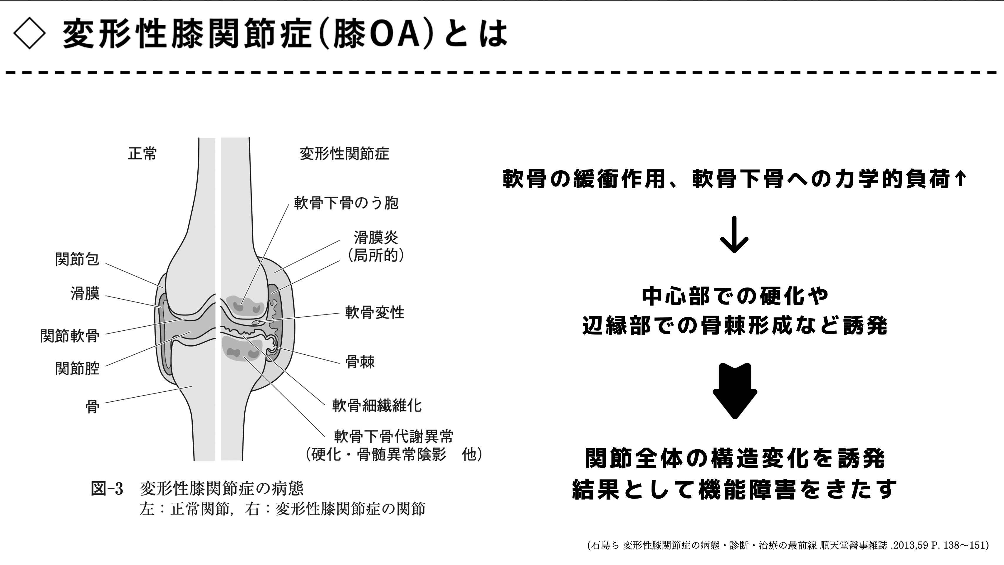 膝関節疾患を担当したら、まず読むnote｜じんた@理学療法士