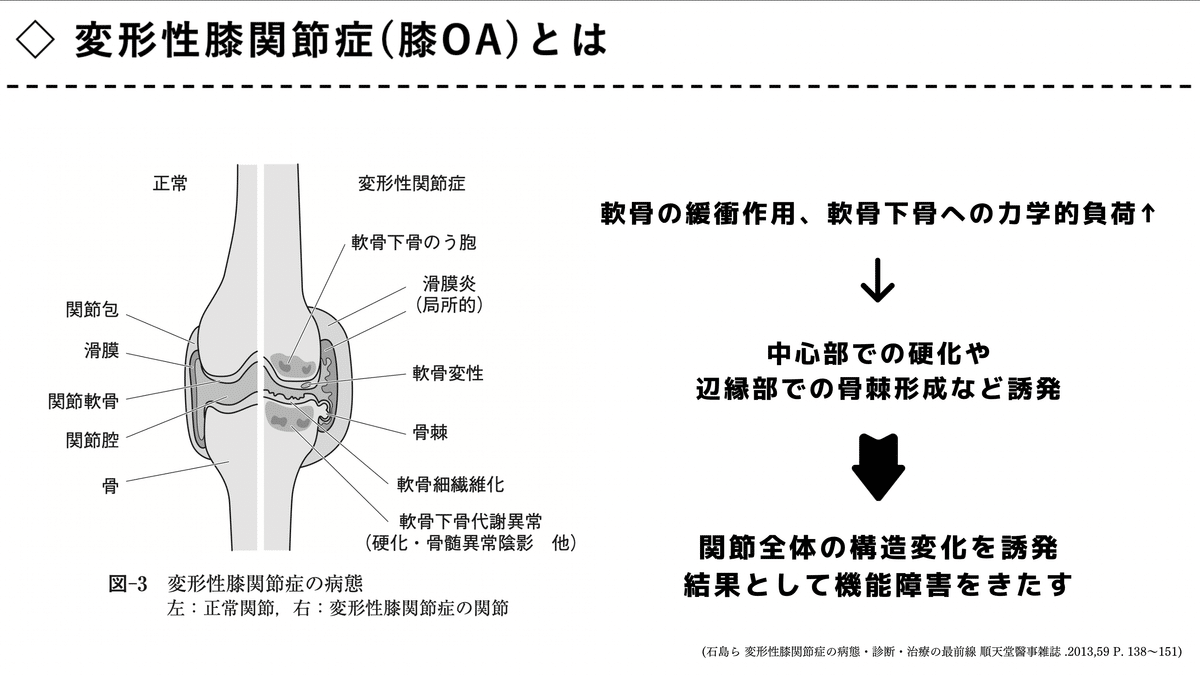 膝関節疾患に対する理学療法 〜変形性膝関節症を中心とした評価