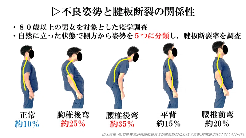 胸郭から考える肩関節の理学療法｜肩関節機能研究会 郷間