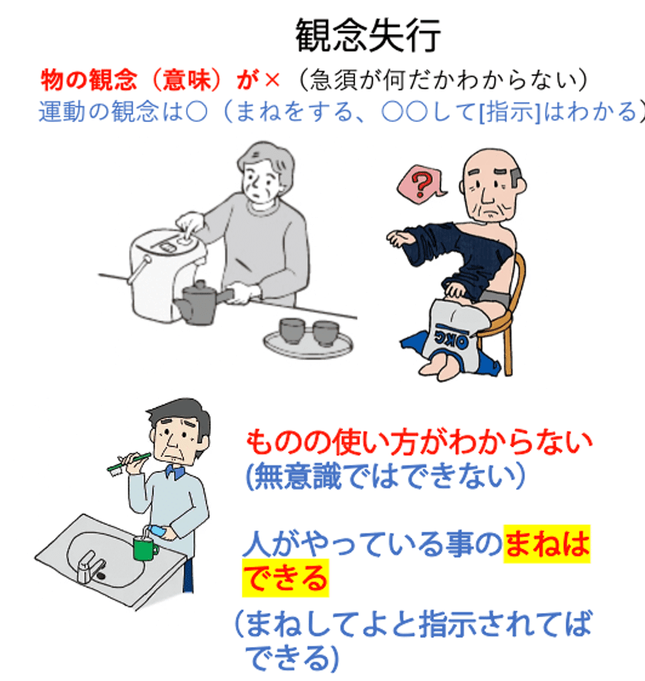 第58回理学療法士国家試験 午後36-40の解説｜Sixty_valleyのページ