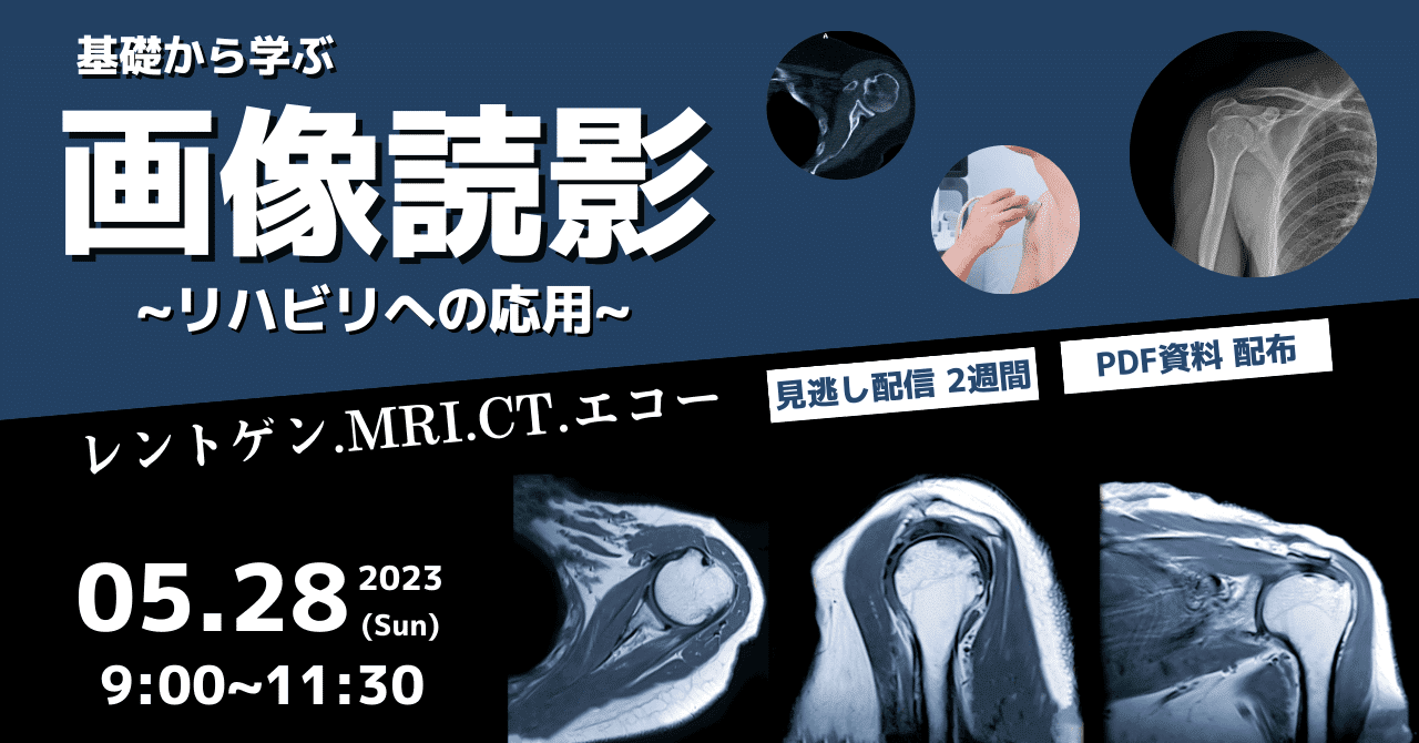 肩関節のMRI?読影ポイントのすべて 肩関節のMRI−読影ポイントの
