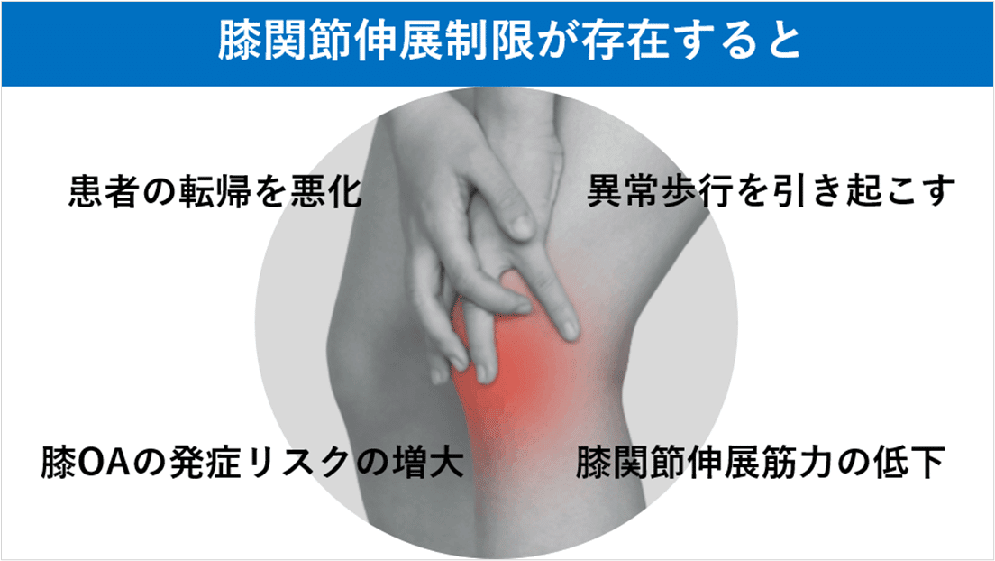 安いそれに目立つ 膝関節伸展制限 ～後方組織の問題を紐解く～｜Y.K 健康・医学