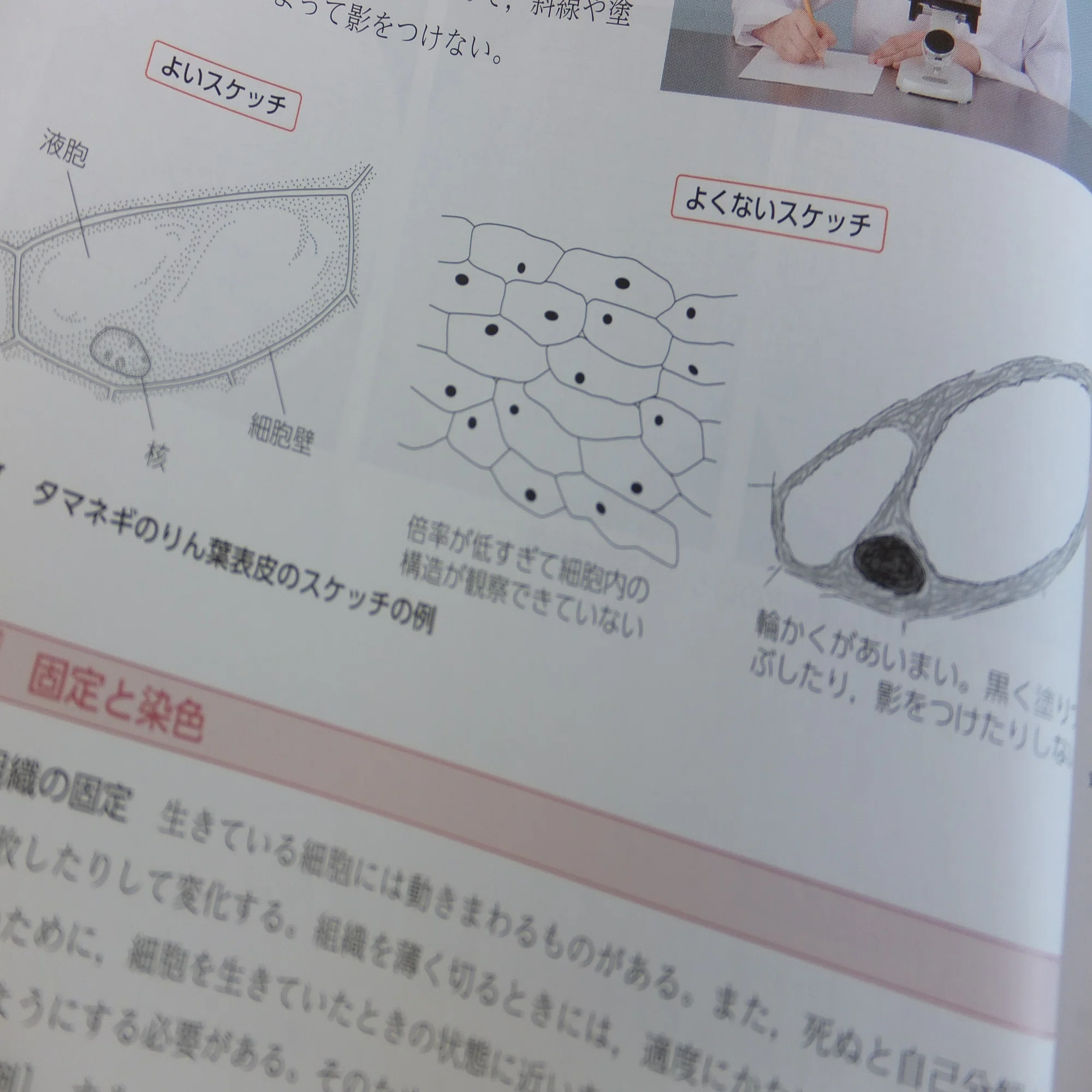 タマネギの細胞液胞