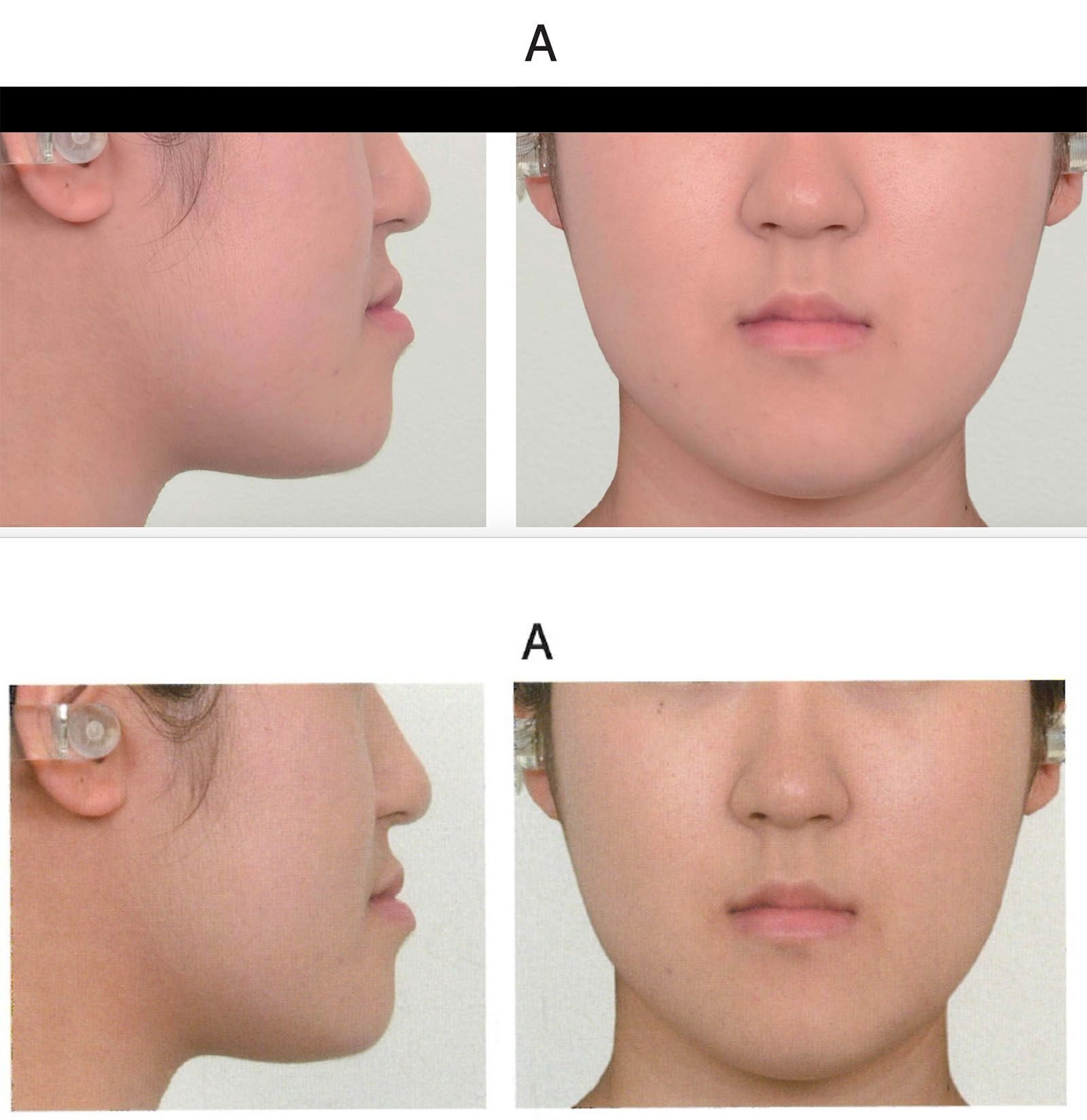 歯科医師国家試験問題集 実践2023 全巻セット＋115回116回 歯科医師国家試験 実践2023 ＋第115回＋第116回