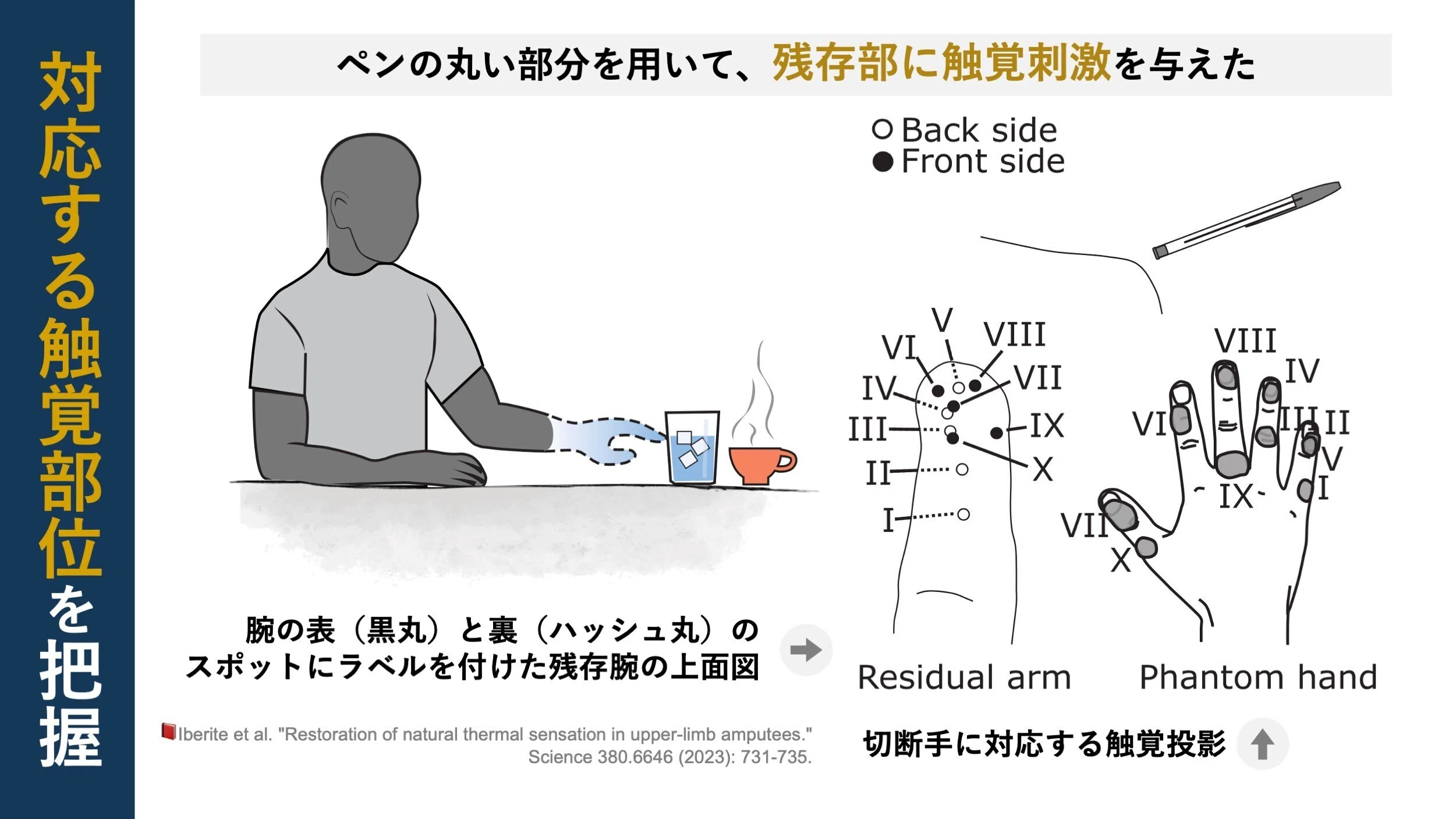温度を感知する”義手開発の第一歩｜Super Human | 理学療法士／保健学