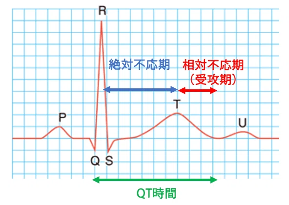 理学療法士国家試験対策 循環器・内部障害難問 57回午後11 QT延長を