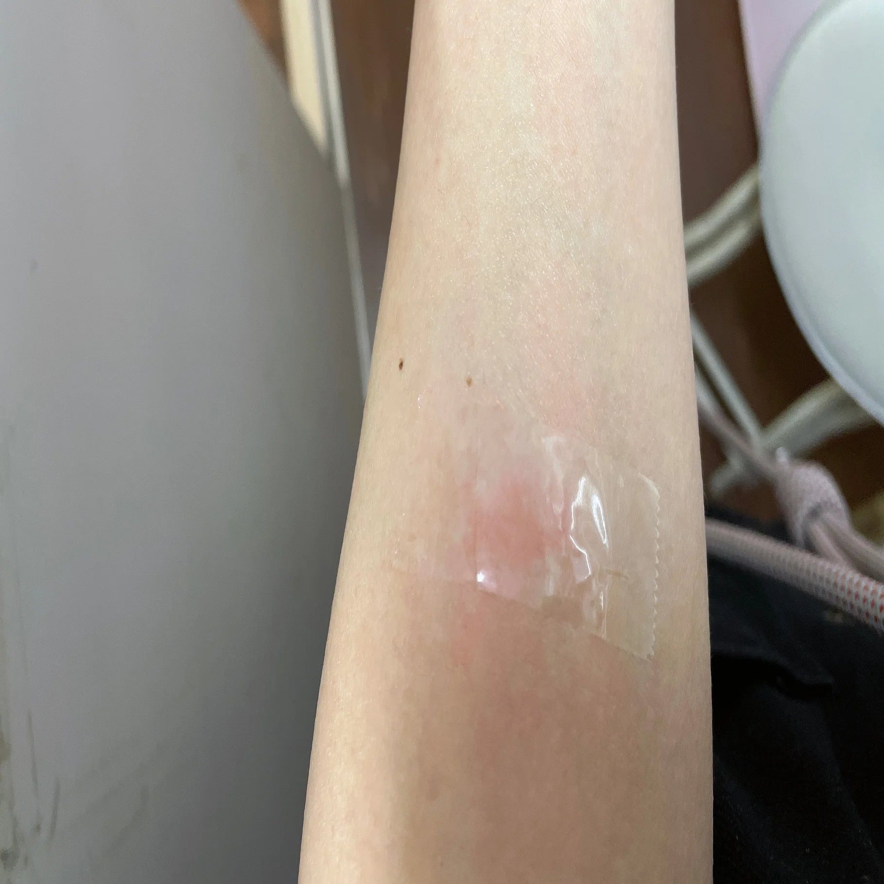 蚊 に 刺され たら セロテープ