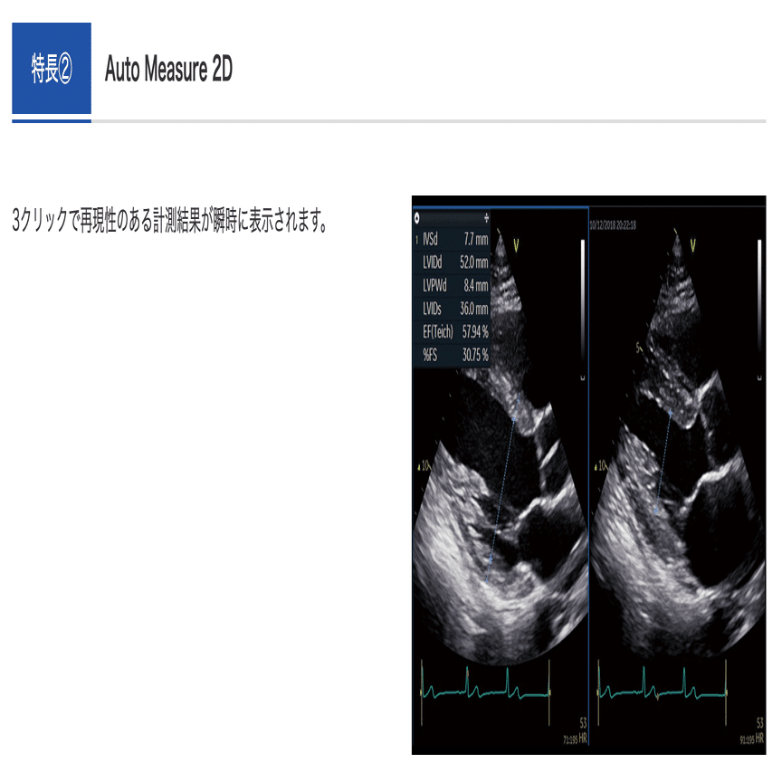 心エコー機器をリニューアルしました｜かわらハートクリニック 前園明寛