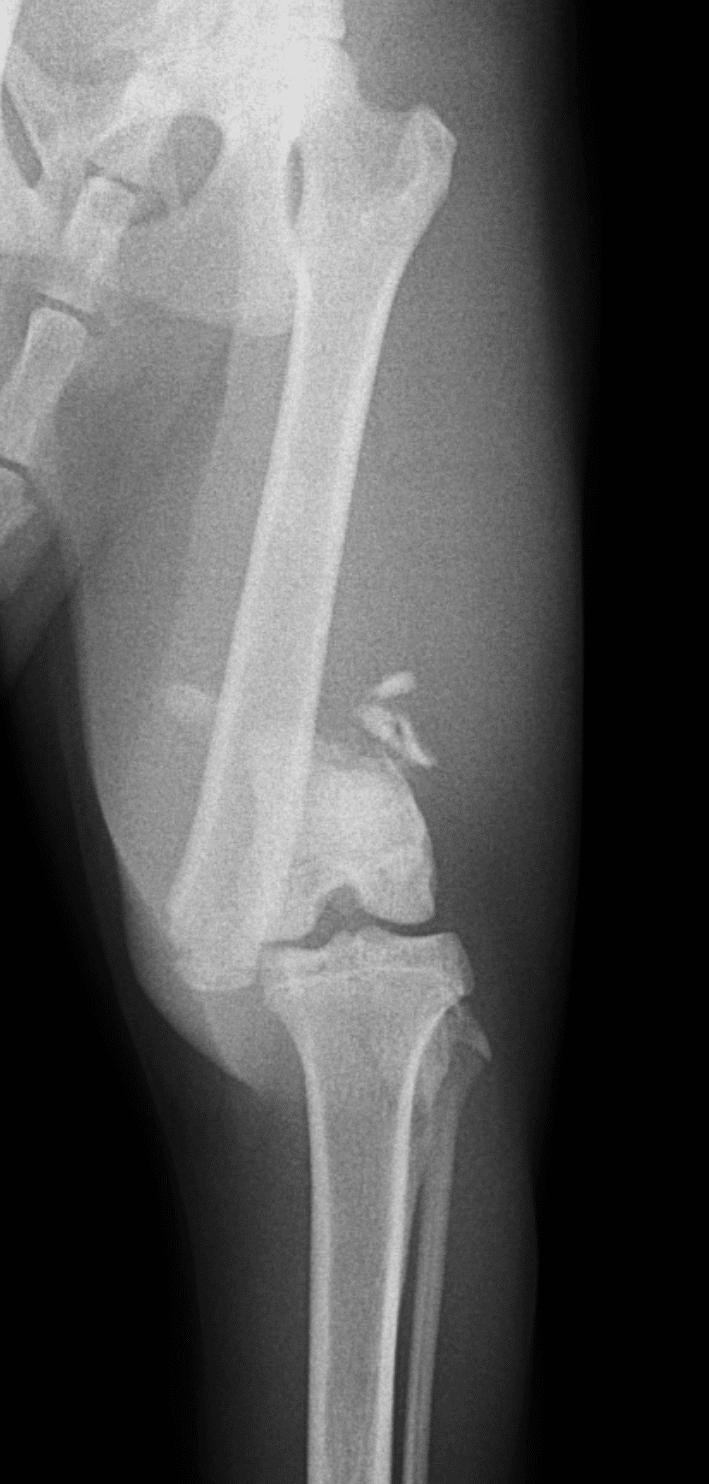 骨折治療 手術アプローチがよくわかる髄内釘・プレート固定