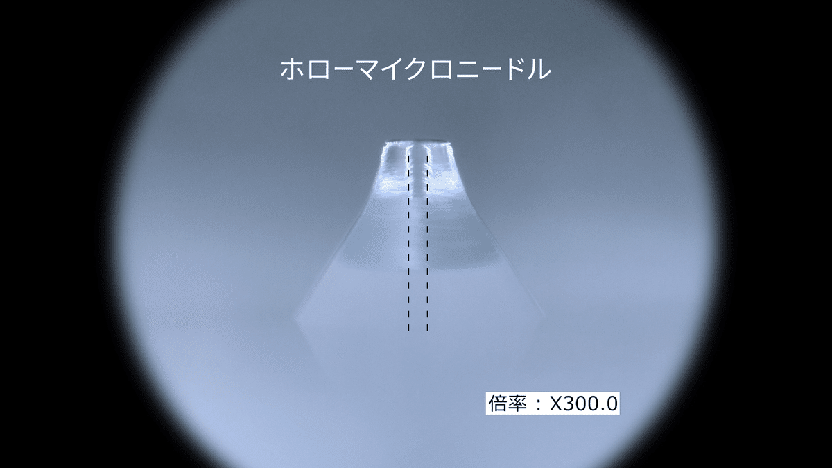 ノック式マイクロニードル「Seleia」に寄せられるよくあるご質問