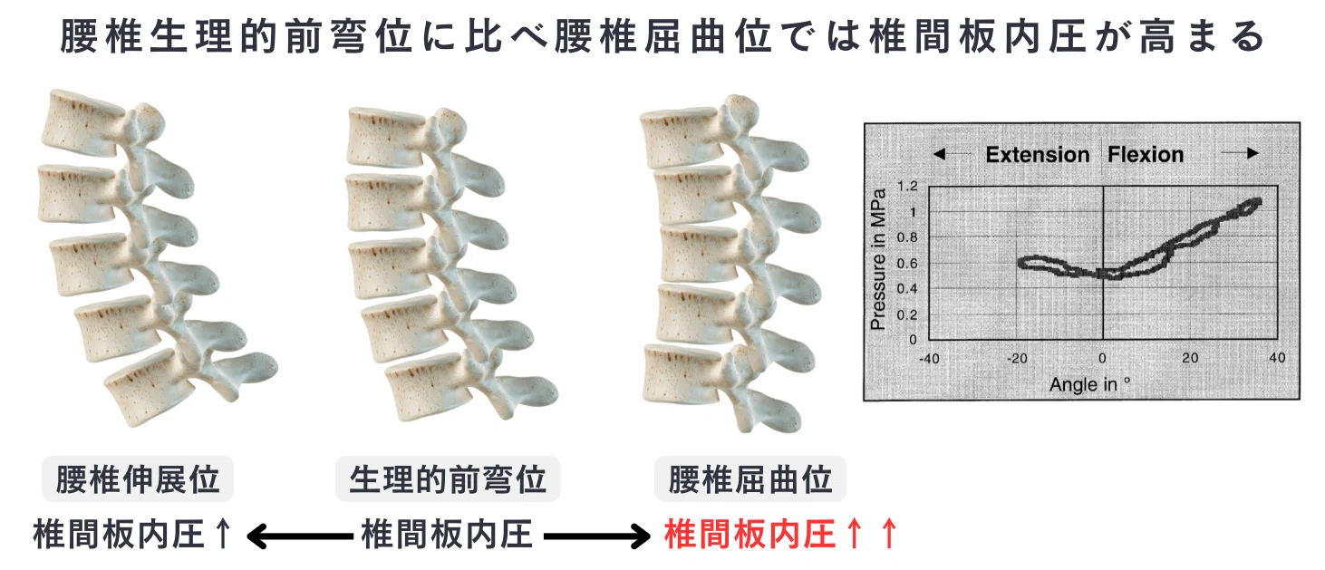 図説腰椎の臨床 腰部痛の理解と臨床実践｜理学療法士による臨床のためのnote