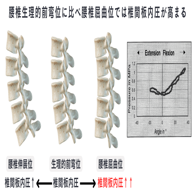 腰部痛の理解と臨床実践｜理学療法士による臨床のためのnote