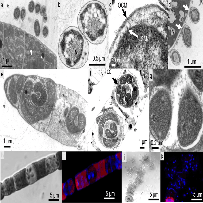 土壌バイオクラスト中のシアノバクテリアに対するバクテリア捕食の高い影響｜哉百名, image size:1501x865