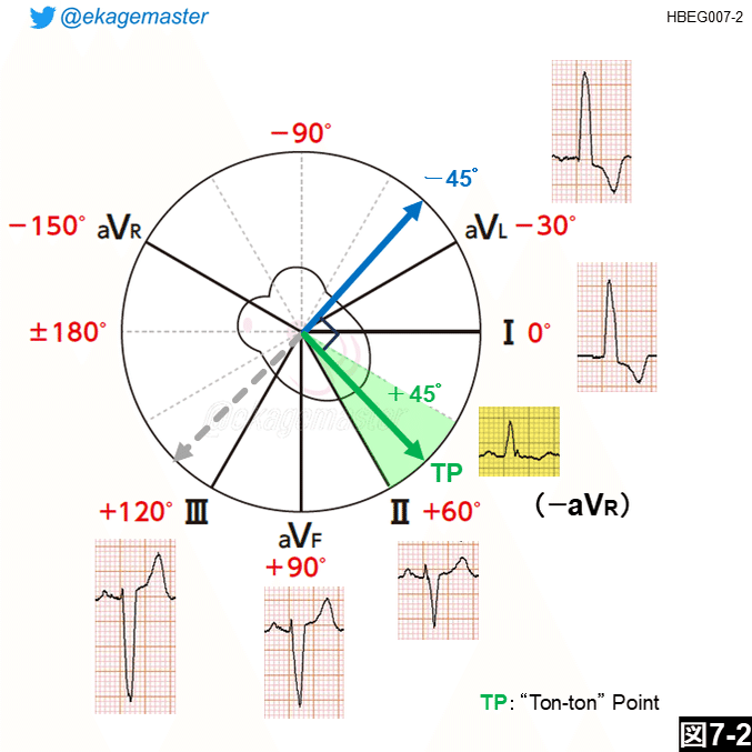 日日の演習心電図【第7回】｜えかげますたぁ｜Dr.ヒロ