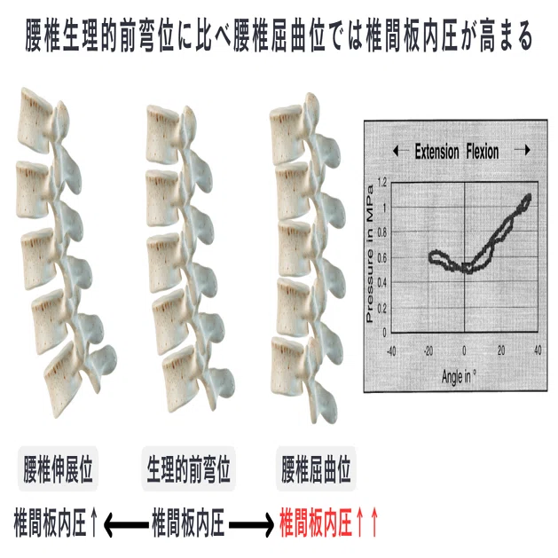 腰部痛の理解と臨床実践【サブスク】｜理学療法士による臨床のためのnote
