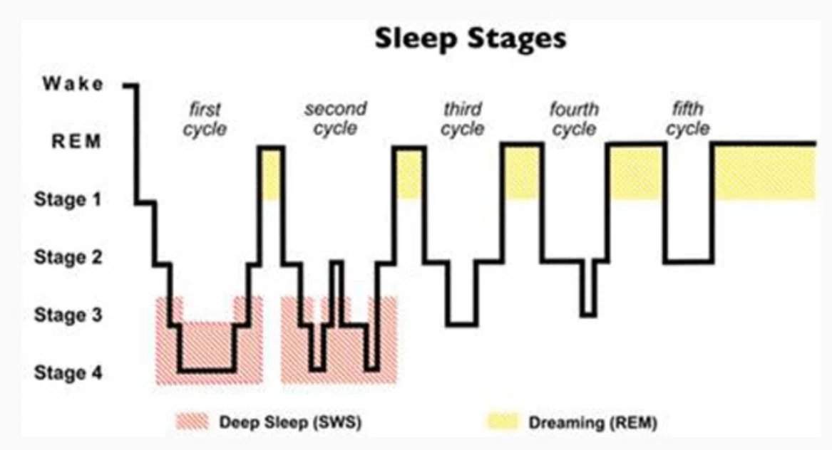 一晩の睡眠経過を示すヒプノグラム。レム睡眠とノンレム睡眠のStage1〜4が周期的に繰り返される様子