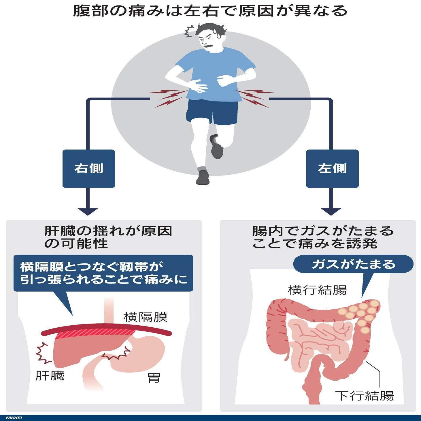 走る と お腹 が 痛く なる
