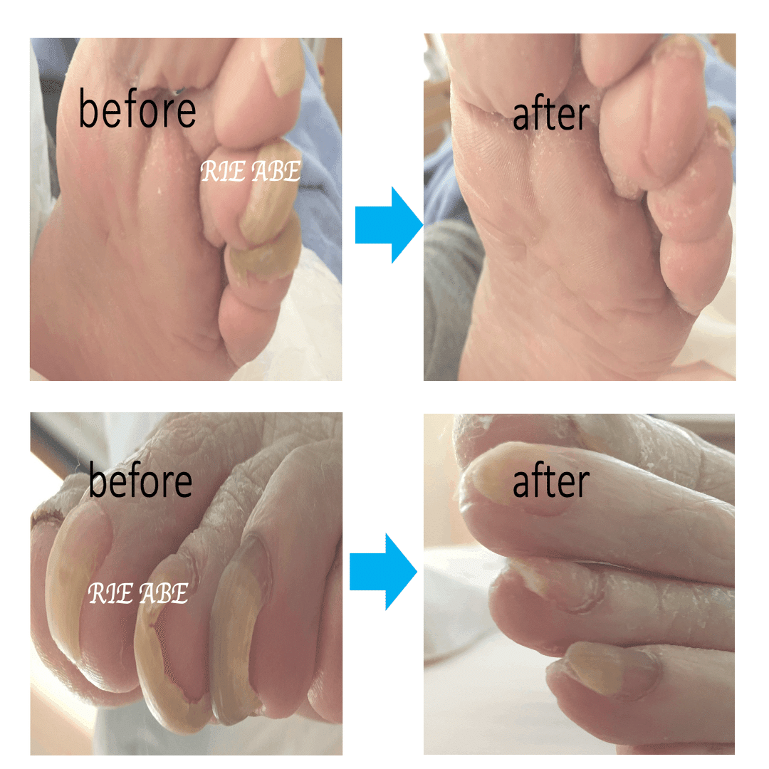 介護保険サービス内でできるフットケアの導入をご検討中の介護事業所