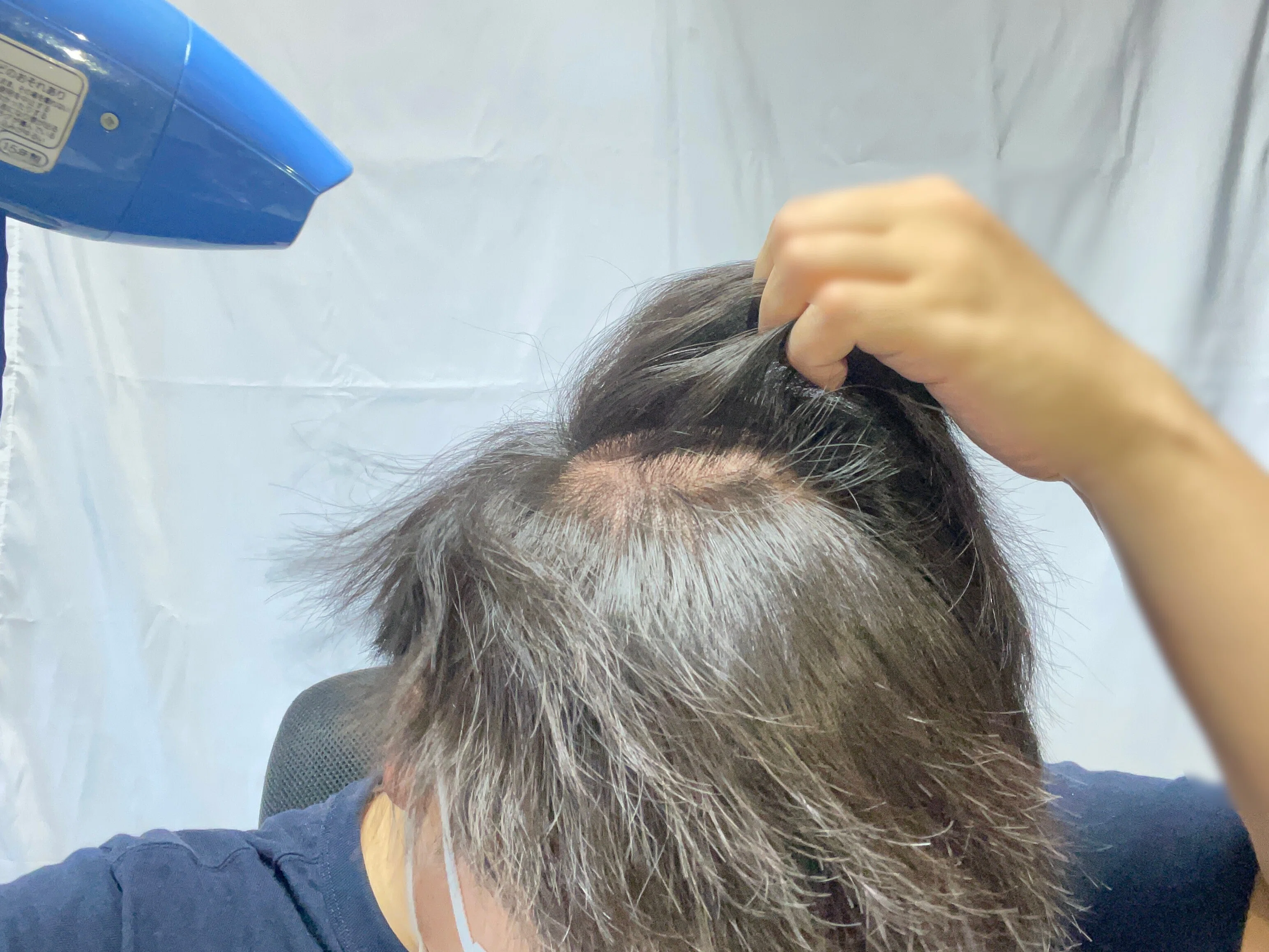 若ハゲのための邪道ヘアセット（前編）！！全スカM字ハゲ必見！！｜ぶる