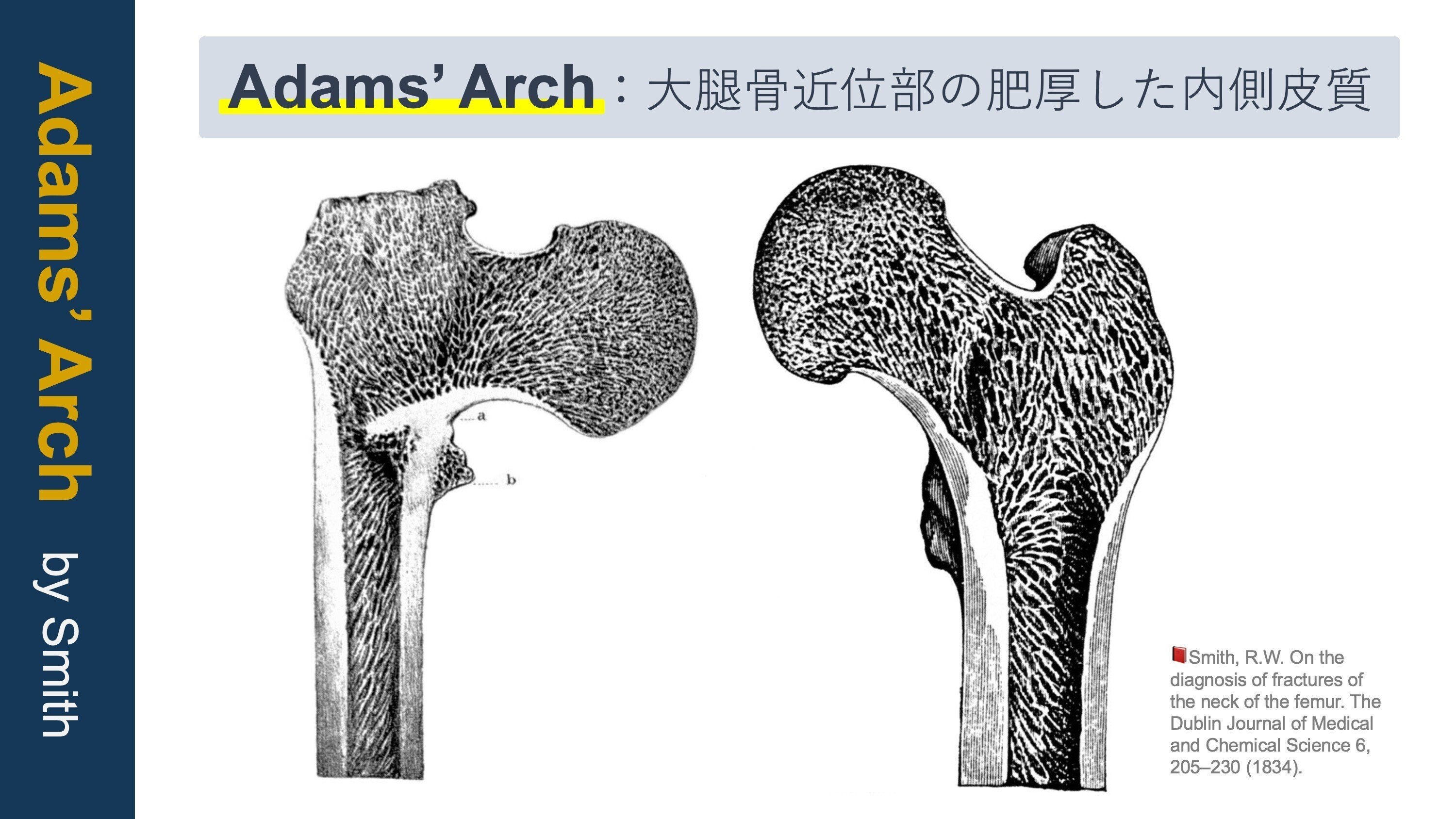 大腿骨近位部骨折｜基礎編 - リハスタ