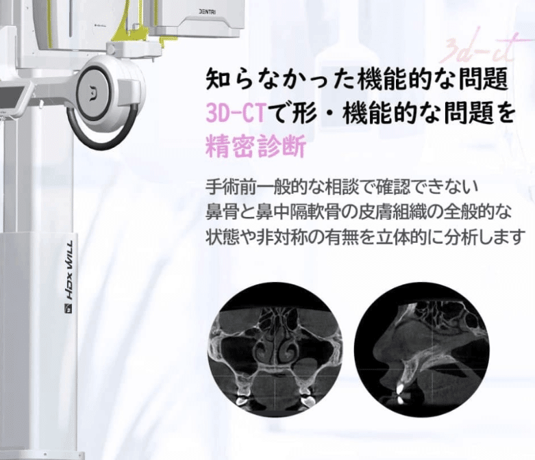 NANA美容外科　鼻整形　CT検査　韓国整形　鼻炎治療