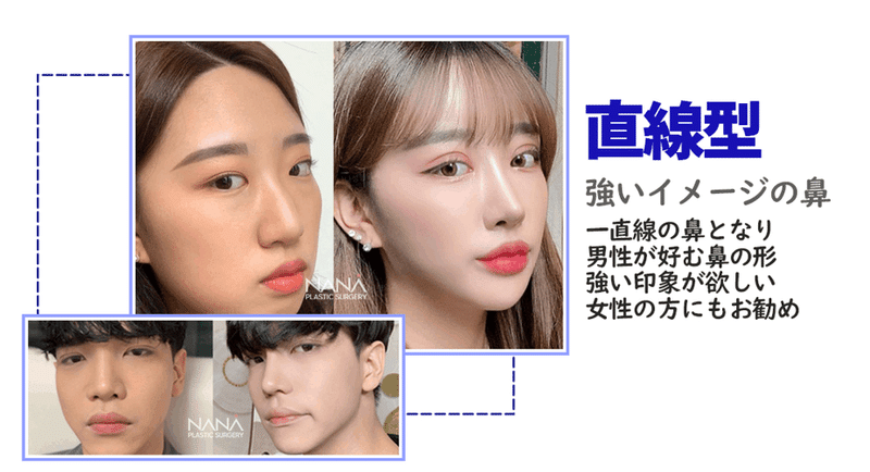 韓国整形　NANA美容外科　鼻整形　直線鼻　スリム　高鼻
