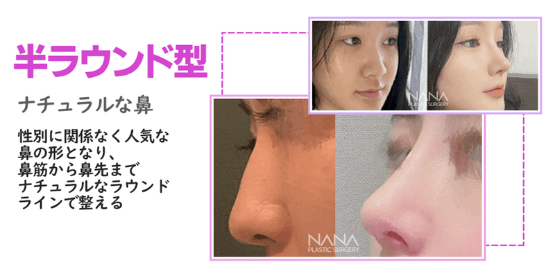 韓国整形　NANA美容外科　鼻整形　ラウンド鼻　スリム　高鼻　お勧め