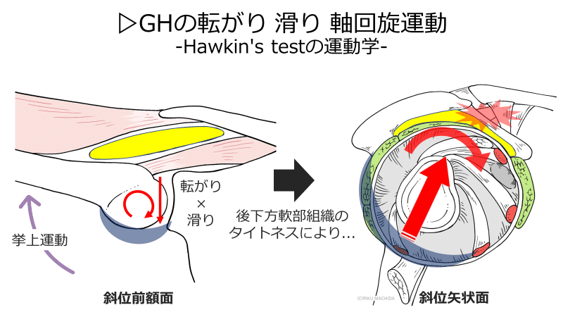 定期購読版】肩峰下インピンジメント-評価と介入-｜肩関節機能研究会 郷間