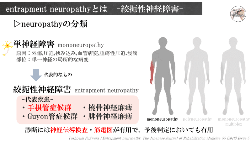 下肢における絞扼性末梢神経障害の評価と治療【全2巻】ME304-S 下肢における絞扼性末梢神経障害の評価と治療～神経系